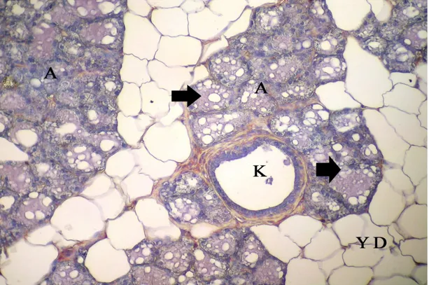 Şekil 4.18. Gebeliğin 21. gününde sıçan memesinde VEGF lokalizasyonu, A: alveol,  K: kanal, YD: yağ doku, alveollerdeki immunreaksiyon gösteren salgı materyali (ok),  X20 