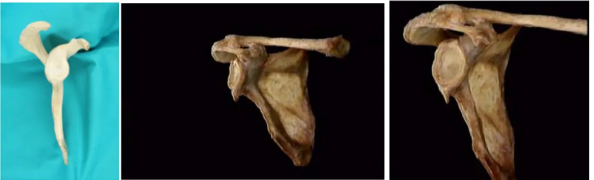Şekil 6 : Scapula anatomik görüntüleri