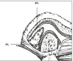 Şekil 3. Kapsüler ligament 