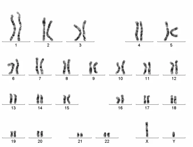Şekil 2. Testiküler Feminizasyonlu olguya ait karyotip 