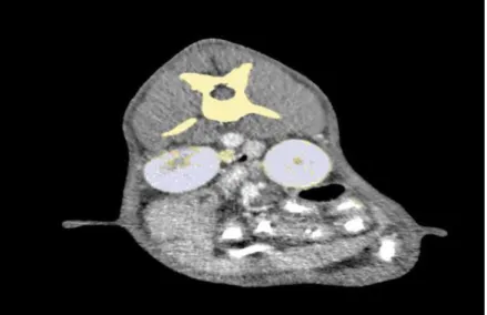 Figure 1. Transverse 2-Dimensional CT image of kidneys.