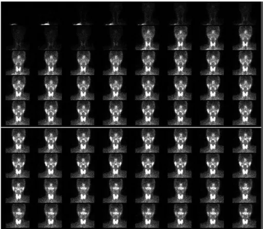 Şekil  1.  Anteriordan  99mTc-perteknetat  ile  yapılan  tükürük  bezi  sintigrafisinin  ardışık  görüntüleri