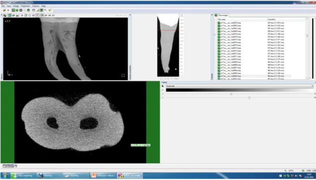 Şekil   3.8:  CTAn   1.13.5.1   (SkyScan,   Kontich,   Belgium)   programı   ile   inceleme   alanı