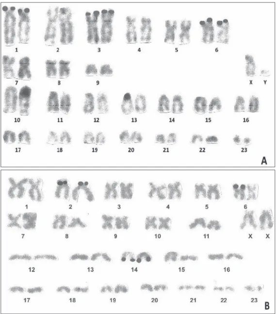 Fig. 2. Ag-NOR stained karyotypes of specimens of Nannospalax nehringi from the Van Province (A) and the Iğdır 