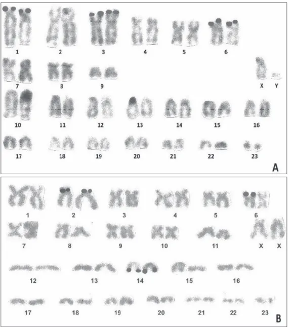 Fig. 2. Ag-NOR stained karyotypes of specimens of Nannospalax nehringi from the Van Province (A) and the Iğdır 