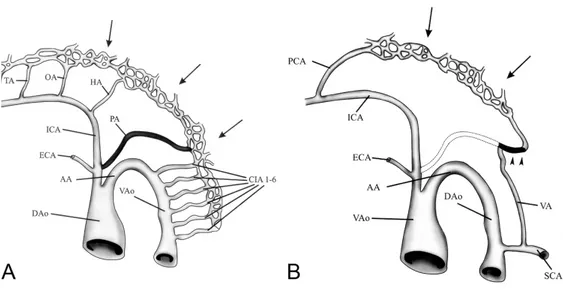 Şekil 4A:   4-5 mm (yaklaşık 1 hf) embriyo aşamasında bilateral longitüdinal nöral arterler  (oklar),  4