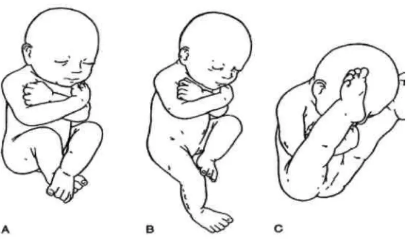 Şekil 1: Prenatal pozisyonlar  