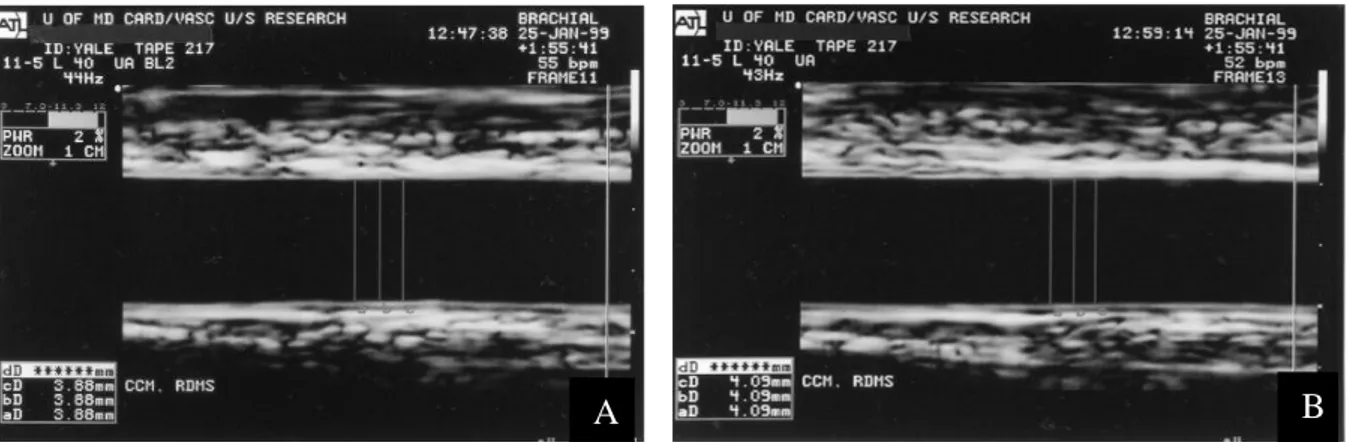 Şekil 9:  Brakiyal arterin ultrasonografik görüntüsü A:Brakiyal arterin bazal görüntüsü