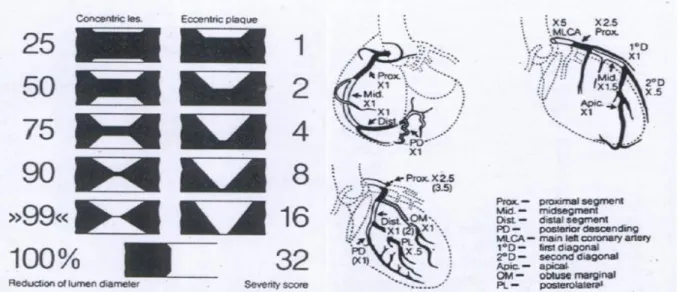 Şekil 4a ve 4b. Gensini Skorlama Sistemi 