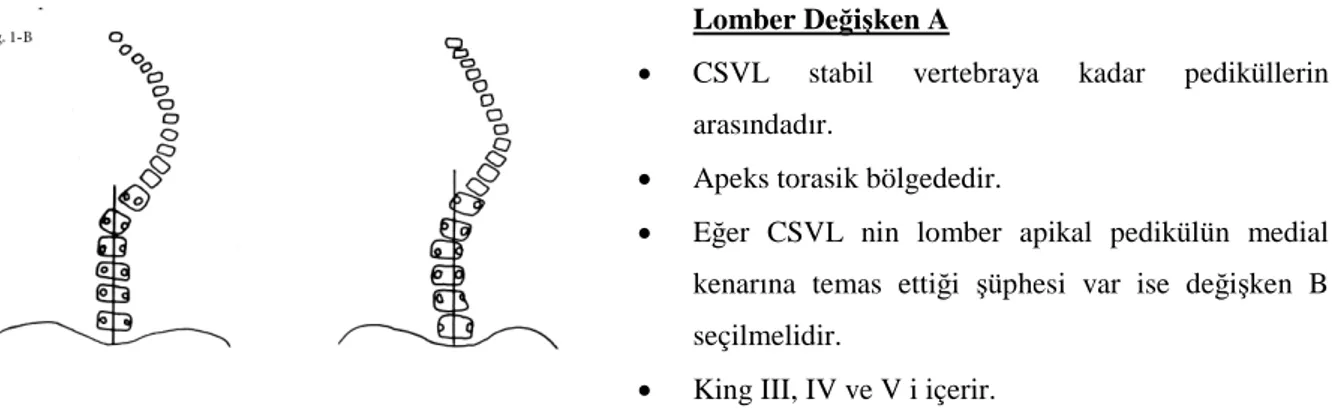 Şekil 11: Lomber değişken A. CSVL stabil vertebraya kadar pediküllerin arasındadır; lomber
