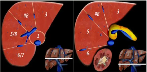 Şekil  12.  Karaciğerin  aksiyel  anatomisi  (inferiordan),  Sol:  RPV  hizasından  Sağ: 