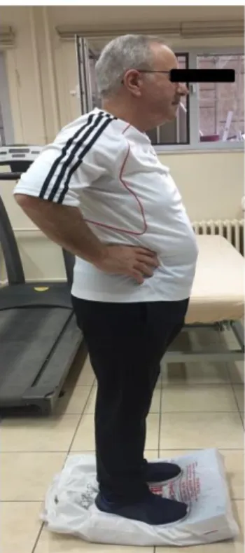 Şekil 3.1. Mini-BESTest ile denge değerlendirmesi. 