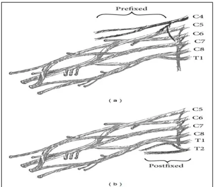 Şekil 2.2. Prefixed ve postfixed brakiyal pleksus (11). 