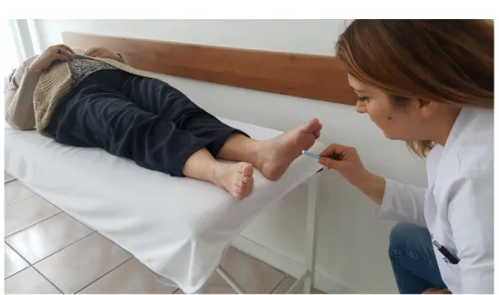 Şekil 3.2. Semmes Weinstein monofilament testi.