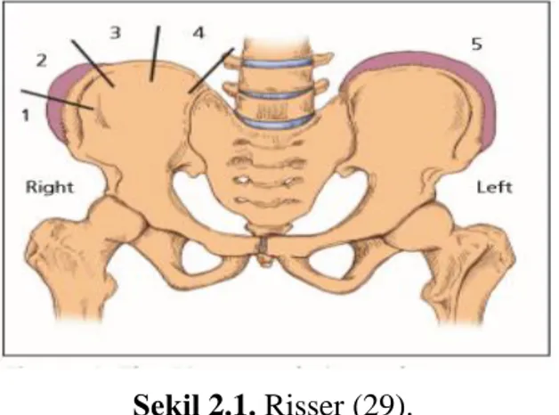 Şekil 2.1. Risser (29). 