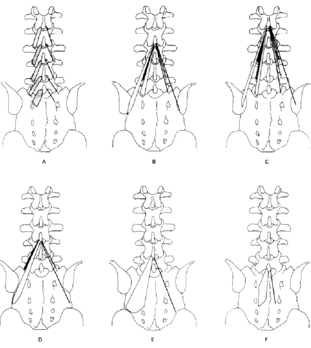 Şekil 2.17. M. Lumbar Multifidusun Anatomik Lokalizasyonu, A: Laminar Lifler, B-F:  Spinöz Çıkıntılardan Kaudale Giden Uzun Lifler (228) 