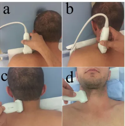 Şekil  3.1.  Kas sertlik  ölçümlerinde ultrasonografi başlığının pozisyonu.  Trapez üst  parça (a), levator skapula (b), splenius kapitis (c) ve sternokleidomastoid (d)