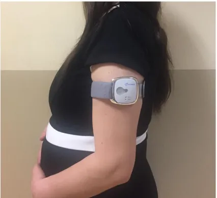 Şekil 3.2. SenseWear Armband. 