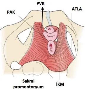 Şekil 2.3. Levator ani kaslarının sakral promontoryumundan üstten görünümü. PVK:  pubovajinal kas, PAK: puboanal kas, ATLA: arcus tendineus levator ani,  İKM: iliokoksigeal kas (DeLancey 2003)