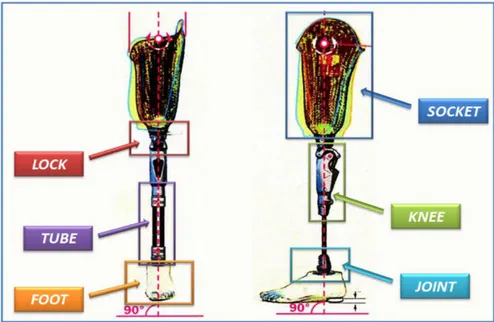 Figure 2.3.Transfemoral prosthesis (40) 