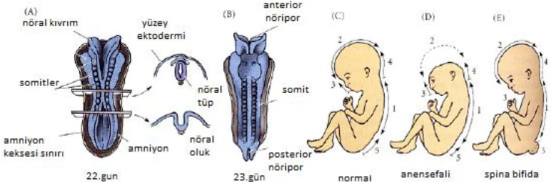 Şekil 2.2. İnsan embriyosunda nörilasyon  defektleri (19)  