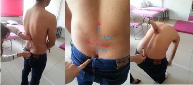 Şekil 3.7. Modifiye Schober Testi 