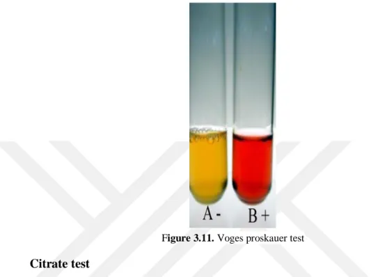 Figure 3.11. Voges proskauer test 