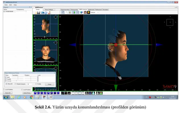 Şekil 2.6.  Yüzün uzayda konumlandırılması (profilden görünüm)