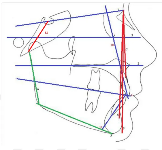 Şekil 2. 30 Çalışmamızda iskeletsel ve dişsel analizler için kullanılan sefalometrik doğrular