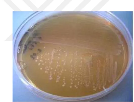 Şekil 2.10. “Brain hearth infusion” (BHI) agar streptococcus mutans kolonileri 