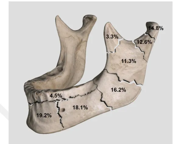 Şekil 32.1 Mandibula kırıklarının anatomik bölgelere göre dağılımı (Afrooz ve ark.  2015)