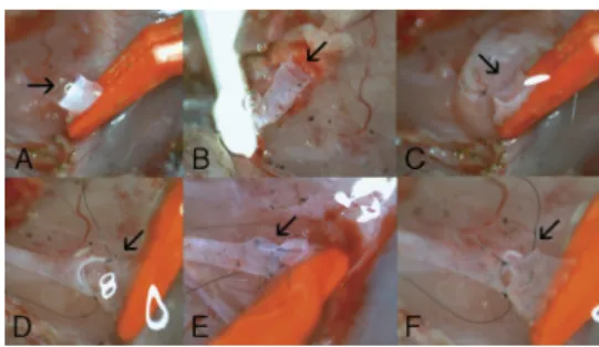 FIGURE 1. The sequential photographs of rat jugular vein using 3.0% Protectalon (VSY Biotechnology) under operating microscope magnification of 30