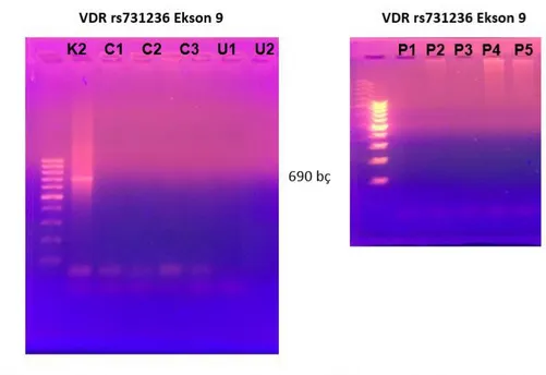 Şekil 4. 3. (a) VDR rs731236 Ekson 9 polimorfizimin gösterilmesi için PZR işlemi  kontrol  (K2),  Crohn  Hastaları  (C1-3),  ülseratif  kolit  hastaları  (U1-2)  için  gerçekleştirildi