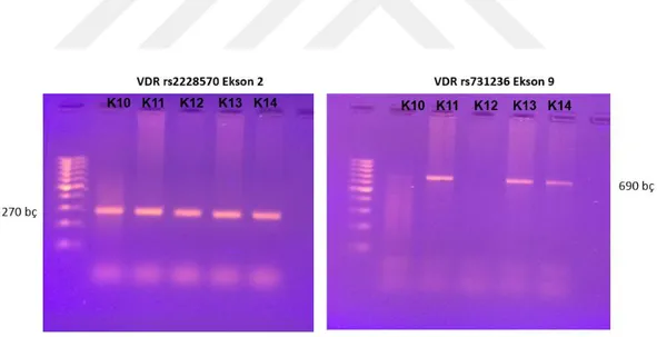 Şekil 4. 5. (a) K10-14 kontrol DNAları kullanılarak VDR Ekson 2 rs2228570 için  PZR ürünleri  elde edildi