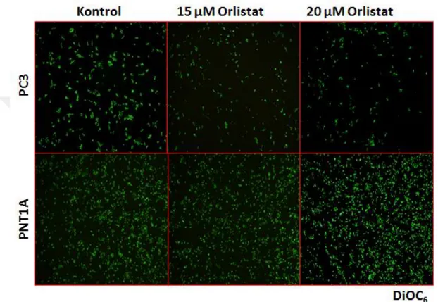 Şekil  4  3.  DiOC6  boyaması  ile  mitokondri  membran  potansiyelinin  Orlistat  farklı  konsantrasyonlarının  24  saat  boyunca  uygulandığı  PC3  ve  PNT1A  hücrelerindeki  değişimler  gösterilmiştir