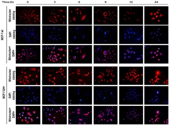 Şekil 4.1. MCF-7 doğal tip ve BH+ meme kanseri hücrelerinde curcuminin (20 µM) hücre canlılığın 