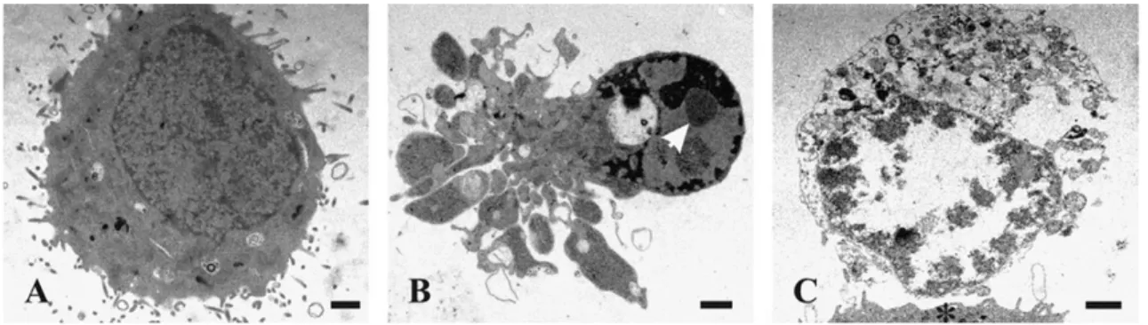 Şekil 1.8. Apoptotik hücre ile nekrotik hücrenin morfolojik olarak farkı.  A, sağlıklı hücre; B, apoptotik hücre; C, nekrotik hücre (Krysko ve ark