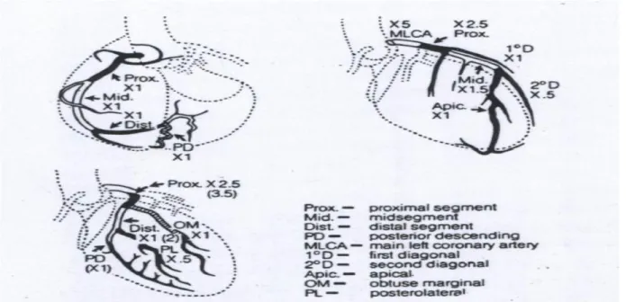 Şekil 4: Gensini skorlamasında kullanılan damar segmentine göre çarpım faktörleri. 