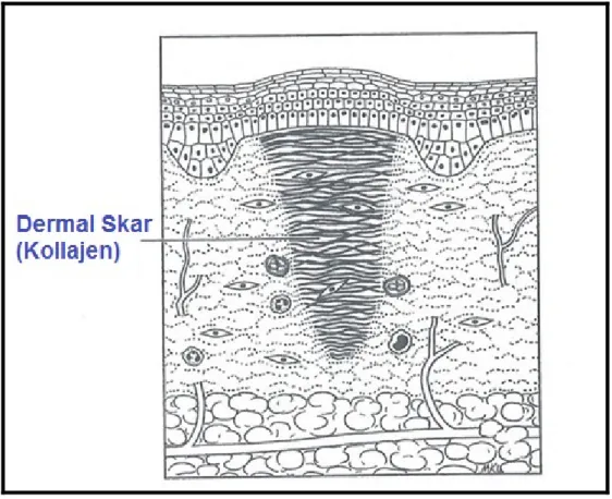 Şekil 5: Skar matürasyonu 9