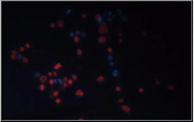 Şekil 2: rhl mutant Pseudomonas aeruginosa suşu ile enfekte edilmiş HEp- 2 hücre dizisinin 
