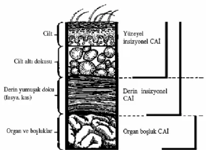 Şekil 1: Cerrahi alan infeksiyonları. (Mangram AJ, Horan TC, Pearson ML, et al. The Hospital  Infection  Control  Practices  Advisory  Committee