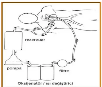 Şekil 11:  Kalp akciğer makinesi. 56