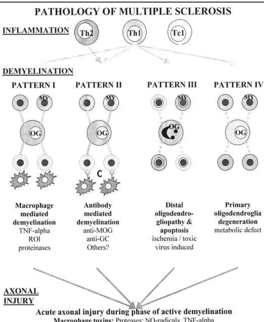Şekil 1: Multipl sklerozun heterojen patogenezi   (23)