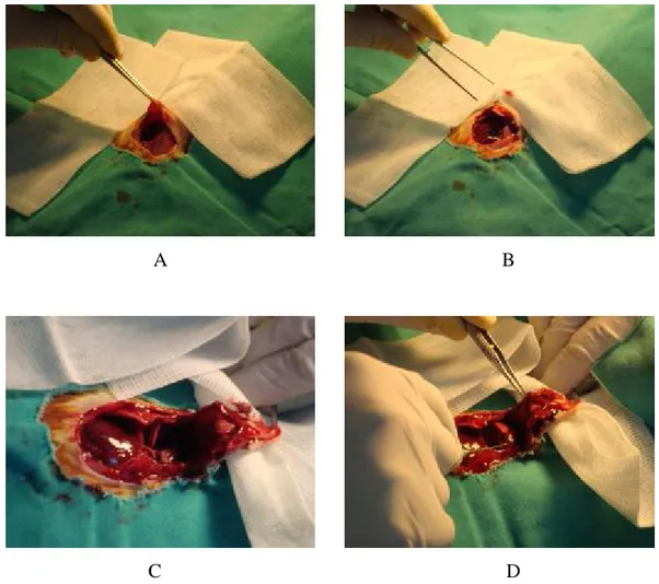 Şekil  6:  Anterior  torakotomi  yaklaşımıyla  kalbe  ulaşılması  ve  doğrudan  intrakardiyak ölçümlerin yapılması (A-D: işlem basamakları) 