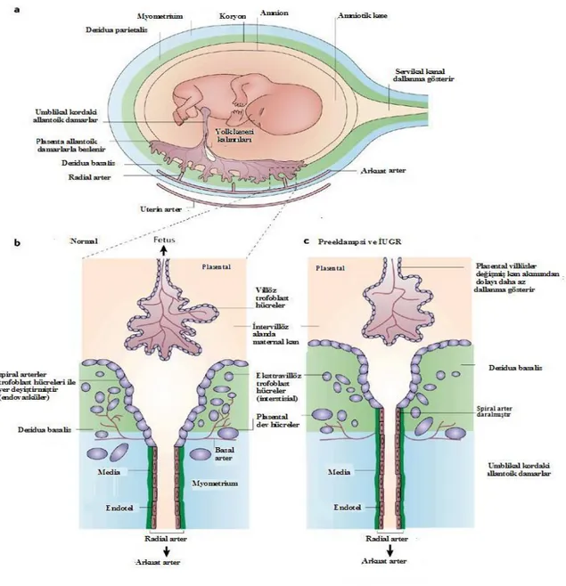 Şekil 2: Trofoblast hücre invazyonu yetersiz oldugunda sipiral arterlerin eksik transformasyonu oluşur