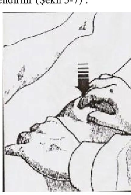 Şekil 5: Efüzyonun değerlendirilmesinde 