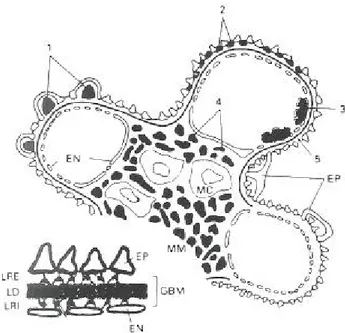 Şekil  3:  Glomerülde  immün  komplekselerin  lokalizasyonu:  1)  Subepitelial  tümsekler  (Akut  GN),  2) 