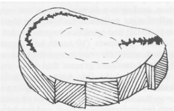 Şekil 6.  Anulus fibrozusun lamellar mimari yapısı ve yırtıkları (radial ve çevresel) 