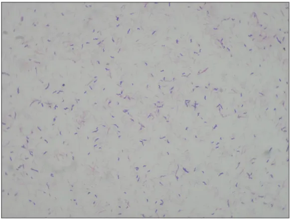 ġekil  1:  mCCDA  besiyerinde  üreyen  Campylobacter  kolonilerinden  hazırlanan  Gram  boyalı  preparatın  X100 büyütmedeki mikroskopik görüntüsü 