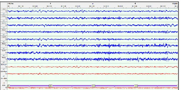 ġekil 6: NREM II evresinde bir nonCAP dönemi  (DEÜTF Epilepsi ve Uyku Ġzlem Lab.)